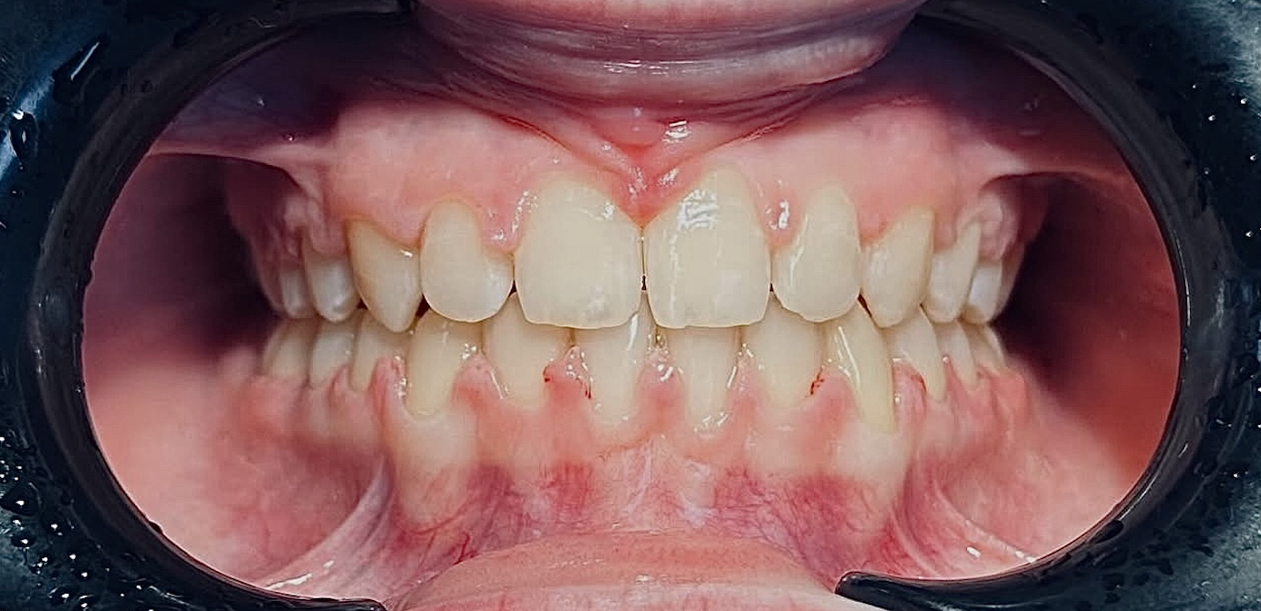 Після 6